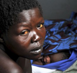 Informe de ONU alerta sobre aumento de enfermedades crónicas en África