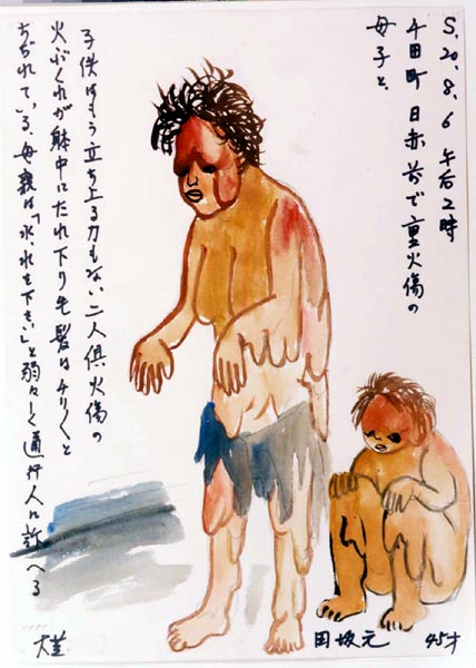 Tasaka Hajime-15- una madre pide agua desesperadamente para su hijo, ambos quemados y con la piel colgando