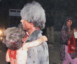Un niño herido en Afganistán.