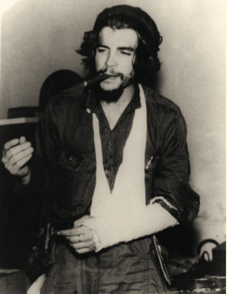 El Che en Cabaiguán, el 22 de diciembre de 1958, después de fracturar- se el brazo izquierdo durante el ataque a ese poblado.