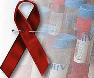 Miles de jóvenes contraen cada año el VIH, indica informe