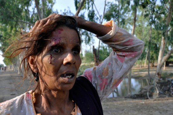 Víctima de las inundaciones, una mujer resulta herida en la cabeza mientras luchaba por los alimentos que se distribuyeron desde un camión en el distrito paquistaní de Muzaffargarh en la provincia de Punjab, el 10 de septiembre 2010. |Foto: Asim Tanveer / Reuters