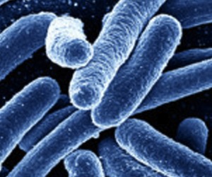 E.coli con estereotipos