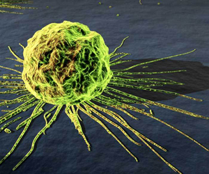 Descubrimiento histórico para el tratamiento de tumores: Las células madre inductoras del cáncer