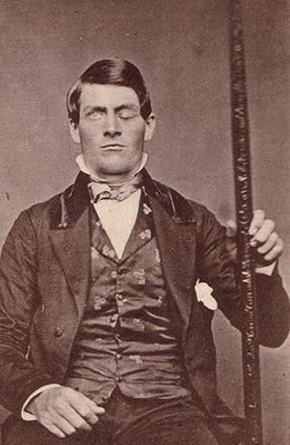 phineas-gage