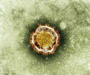 Francia informa del primer caso del nuevo virus similar al SARS