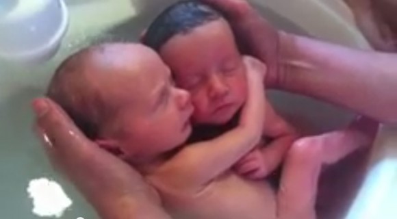 Los gemelos se abrazan, como si aún estuvieran dentro del vientre materno