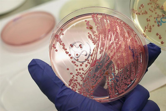 Debilidad en superbacterias hará posible crear nuevos fármacos