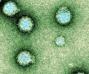 chikungunya-virus