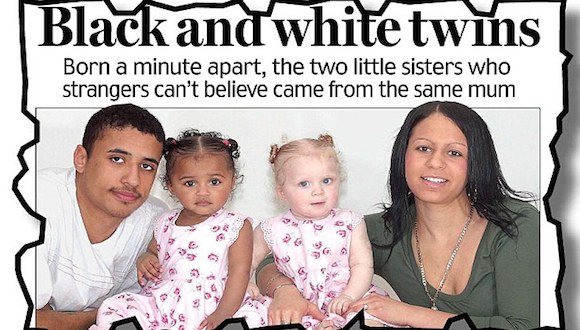 Las hermanas Kian y Remee con sus padres. Foto publicada por el Daily Mail en el 2006.