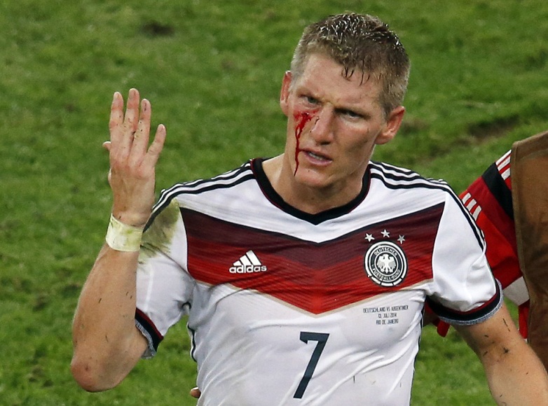 Germany's Bastian Schweinsteiger reacts as blood flows down his face after he was fouled during their 2014 World Cup final against Argentina at the Maracana stadium in Rio de Janeiro
