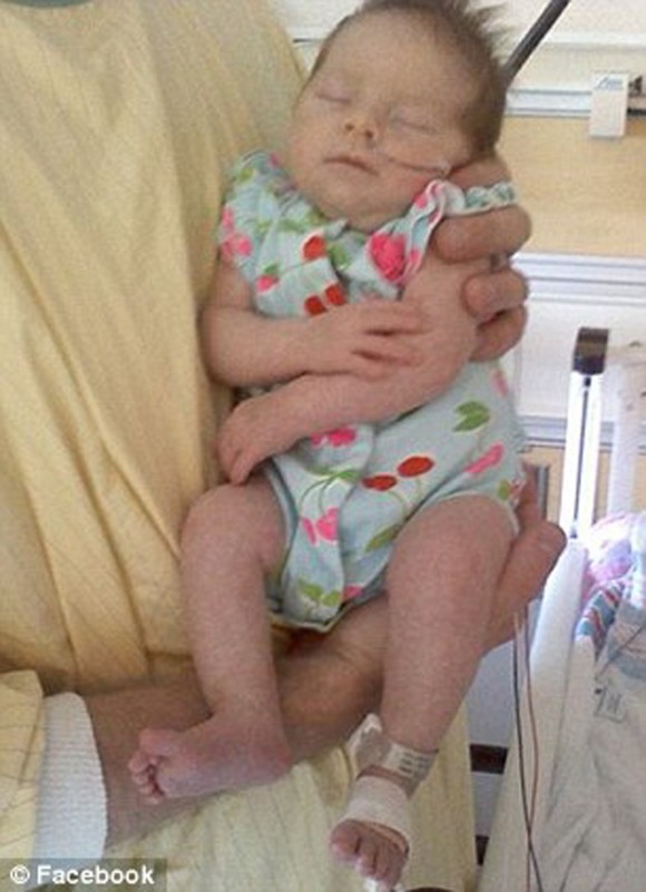Tras ser golpeada hace un año por un rayo, bebé mantiene electricidad estática en su cabello. Foto: Daily Mail.