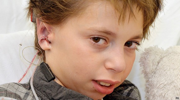 Kieran nació sin las dos orejas. Foto: BBC Mundo