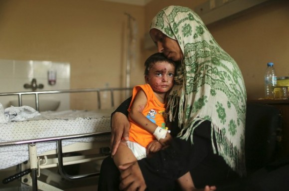 Un niño palestino que sufrió heridas en un bombardeo israelí, se recupera de sus heridas en el hospital Shifa, en Gaza, el 14 de agosto de 2014. Foto: Reuters.