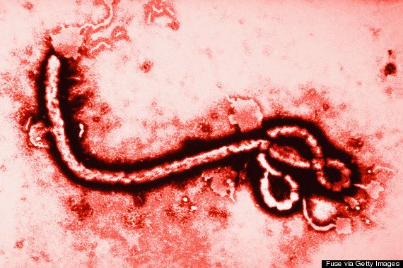 Virus del Ébola. Foto: Getty Images.
