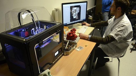 Un empleado prepara la impresión en 3D del cráneo de un paciente. Foto: AFP