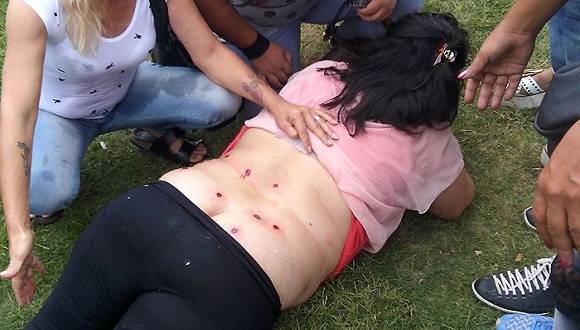 Una mujer que fue internada por haber recibido 15 tiros de bala de goma, como resultado de la represión. Foto: AN Digital