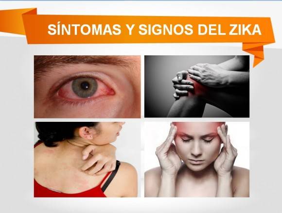 Síntomas Zika