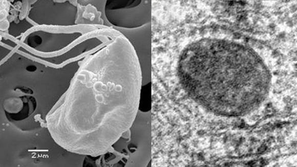 Descubren microbio capaz de vivir sin mitocondrias. Foto: protistologie.cz 
