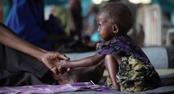 Las organizaciones de ayuda humanitaria advierten el riesgo de que a las muertes por hambre se sumen a otras por enfermedades relacionadas con la falta de agua.