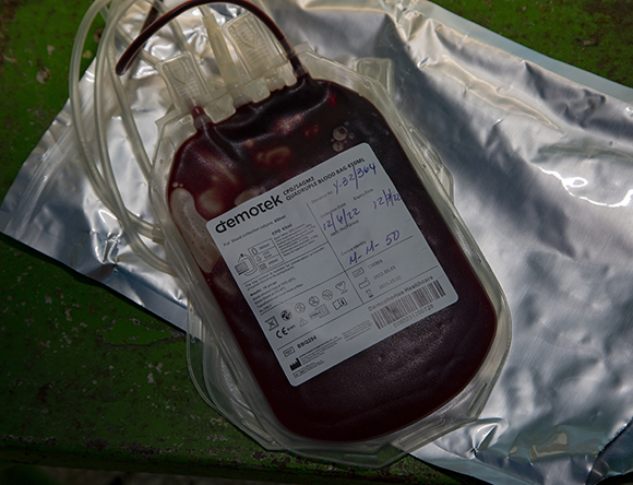 Bolsa en que se recolecta la sangre donada por una persona. Foto: Ismael Francisco/ Cubadebate.